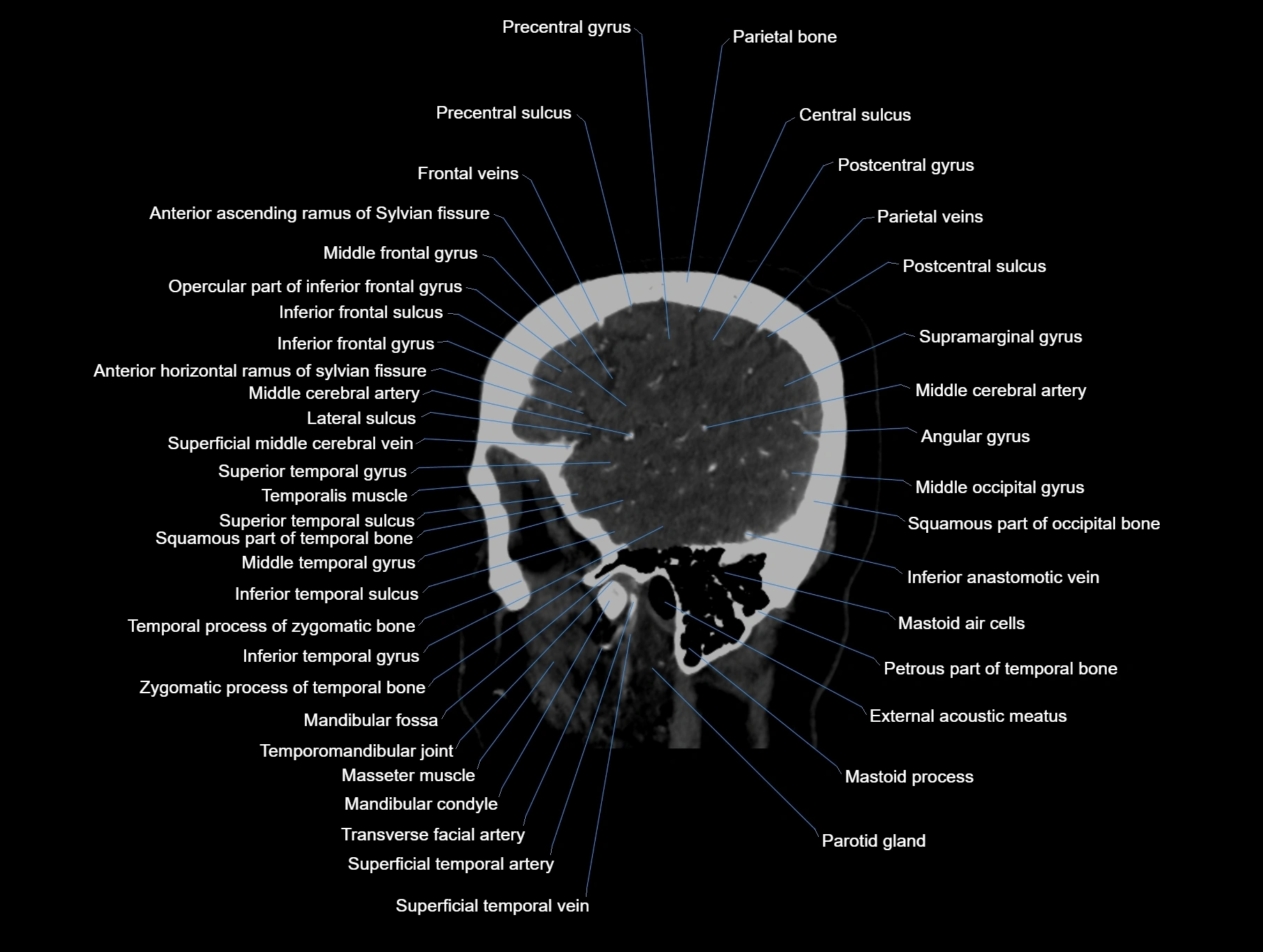 CT scan brain sagittal cross sectional anatomy image-img-00001-00013.webp